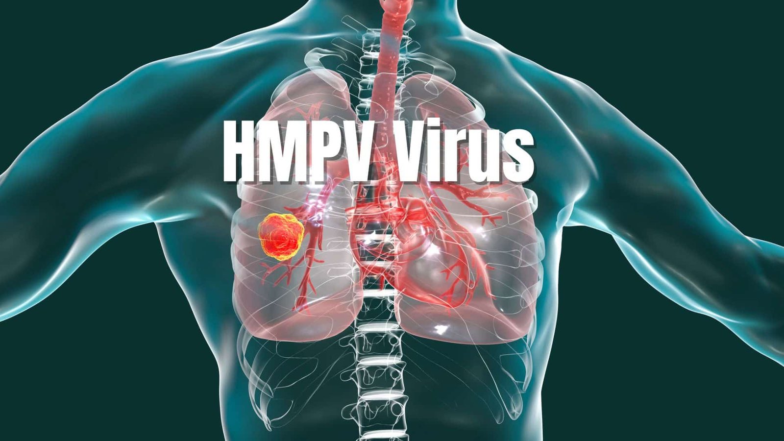 Virus HMPV: Penyebab Infeksi Pernapasan Akut yang Gejalanya Mirip COVID-19, Apa yang Perlu Anda Ketahui?