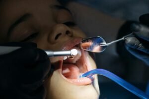 Tak Perlu Khawatir Lagi! Gigi Palsu Ditanggung BPJS Kesehatan, Ini Besaran Bantuannya