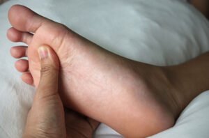 Asam Urat di Usia Muda? Ini Fakta Mengejutkan dan Cara Mencegahnya!
