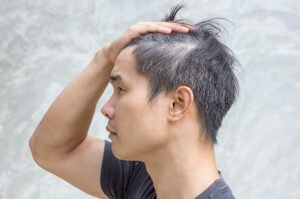Uban Datang Lebih Cepat? Ini Penyebab Uban di Usia Muda yang Wajib Kamu Tahu!