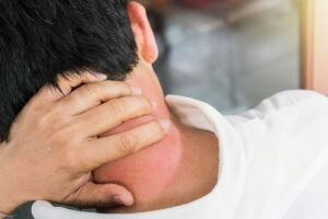 Leher Nyeri Saat Menoleh? Begini Cara Mengatasinya dan Tanda Kamu Harus Segera ke Dokter