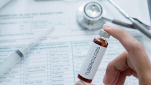 Jangan Sampai Terhenti! Ini Alasan Mengapa Minum Obat TBC Tidak Boleh Putus