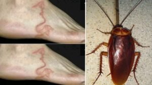 Kecil-Kecil Berbahaya: Mengungkap Ancaman Kesehatan dari Kecoa di Rumah Anda